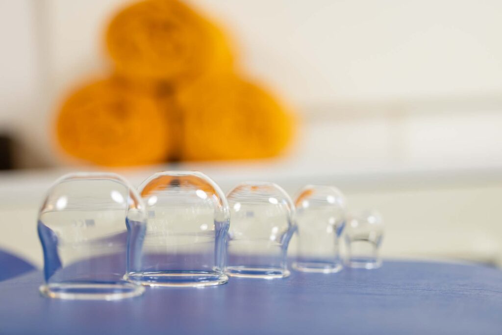 Bindegewebsmassage Yassmin Durtschi Diemassagepraxis